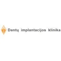 Implantatas, UAB